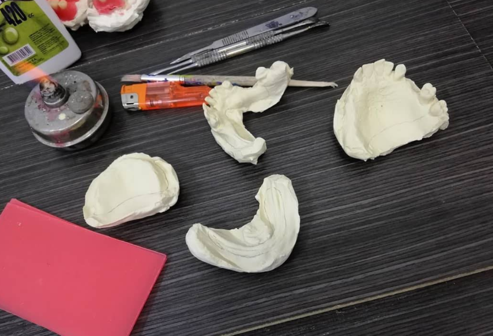 Hasil kerja JOE DENTAL — gigi palsu lepasan buatan tukang gigi Bandung (foto 2)